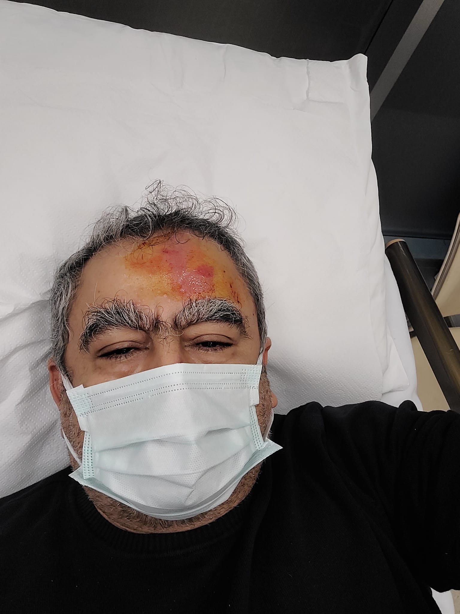 Prof.Dr. İskender AKKURT ve ailesi kaza geçirdi